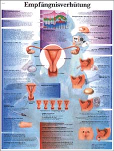 Lehrtafel - Empfängnisverhütung Lehrtafel - Empfängnisverhütung