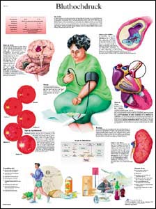 Lehrtafel - Bluthochdruck Lehrtafel - Bluthochdruck