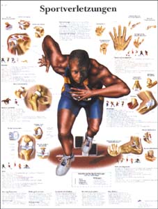 Lehrtafel - Sportverletzungen Lehrtafel - Sportverletzungen