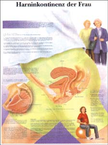 Lehrtafel - Harninkontinenz der Frau Lehrtafel - Harninkontinenz der Frau