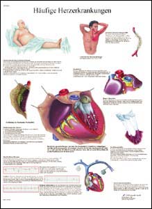 Lehrtafel - Häufige Herzerkrankungen Lehrtafel - Häufige Herzerkrankungen