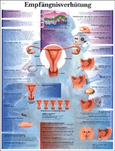 Lehrtafel - Empfängnisverhütung