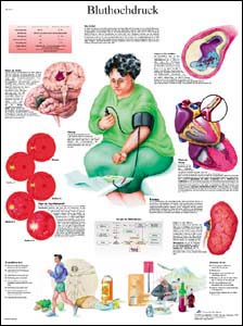 Lehrtafel - Bluthochdruck