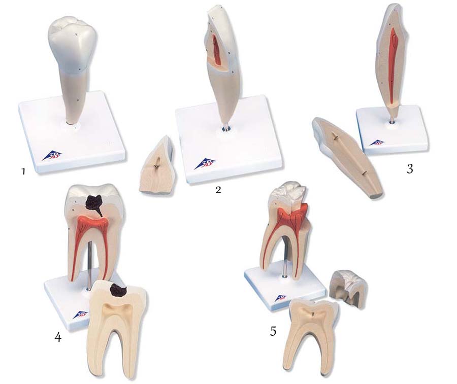 Zahnmodelle - 5 Modelle