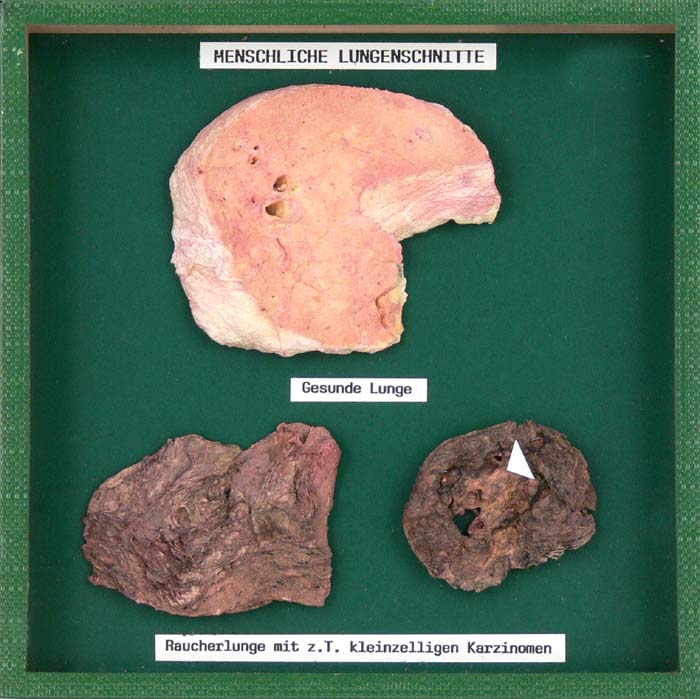 Schaukasten - Raucherlunge