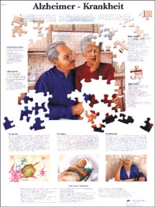 Lehrtafel - Alzheimer - Krankheit Lehrtafel - Alzheimer - Krankheit